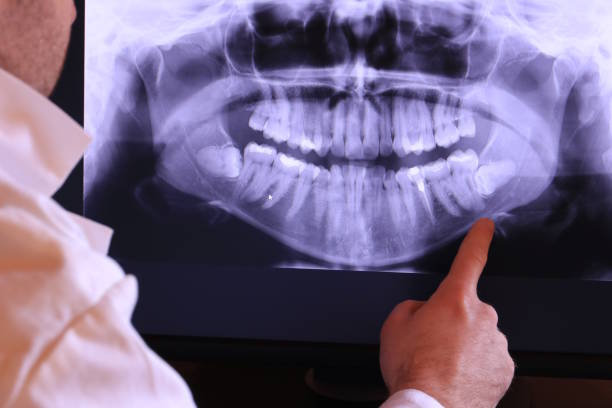 Best Dentist for Tooth Abscess  in Williamsburg, FL