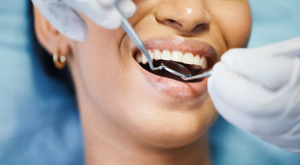 Best Urgent Tooth Repair  in Williamsburg, FL